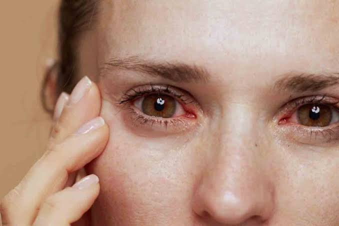 What Are The Signs Of Iron Deficiency?